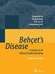 Behcet's Disease