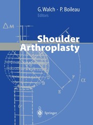 Shoulder Arthroplasty