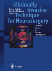 Minimally Invasive Techniques for Neurosurgery