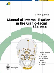 Manual of Internal Fixation in the Cranio-Facial Skeleton