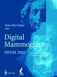 Digital Mammography