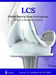 LCS (R) Mobile Bearing Knee Arthroplasty