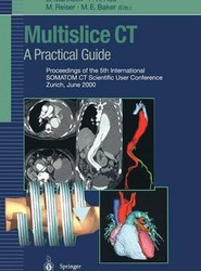 Multislice CT: A Practical Guide