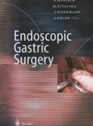 Endoscopic Gastric Surgery