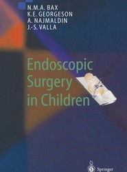 Endoscopic Surgery in Children