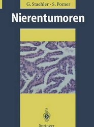 Nierentumoren