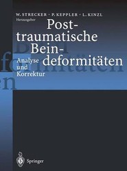 Posttraumatische Beindeformitaten