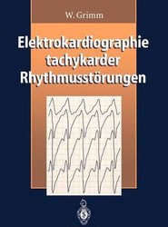 Elektrokardiographie tachykarder Rhythmusstoerungen
