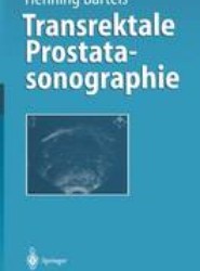 Transrektale Prostatasonographie