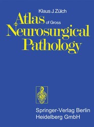 Atlas of Gross Neurosurgical Pathology