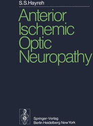 Anterior Ischemic Optic Neuropathy