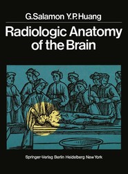 Radiologic Anatomy of the Brain