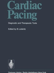 Cardiac Pacing