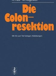 Die Colonresektion