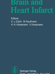 Brain and Heart Infarct