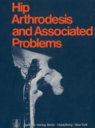 Hip Arthrodesis and Associated Problems