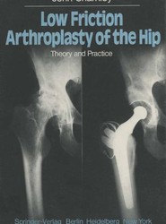 Low Friction Arthroplasty of the Hip