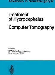 Treatment of Hydrocephalus Computer Tomography