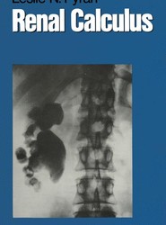 Renal Calculus