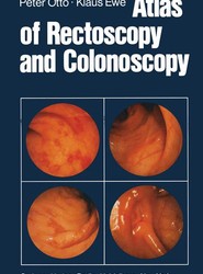 Atlas of Rectoscopy and Coloscopy