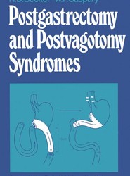 Postgastrectomy and Postvagotomy Syndromes