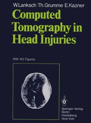 Computed Tomography in Head Injuries
