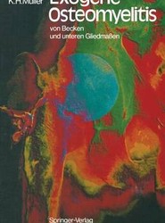 Exogene Osteomyelitis von Becken und unteren Gliedmassen