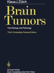 Brain Tumors