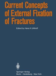 Current Concepts of External Fixation of Fractures