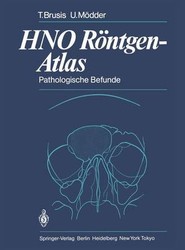HNO Roentgen-Atlas