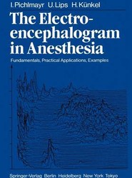The Electroencephalogram in Anesthesia