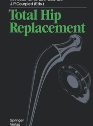 Total Hip Replacement