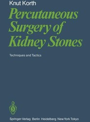 Percutaneous Surgery of Kidney Stones