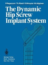 The Dynamic Hip Screw Implant System