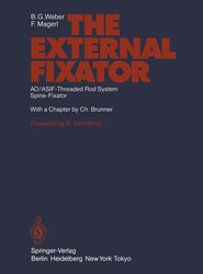 The External Fixator