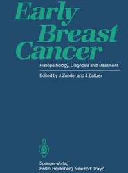 Early Breast Cancer