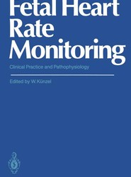 Fetal Heart Rate Monitoring