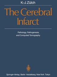 The Cerebral Infarct