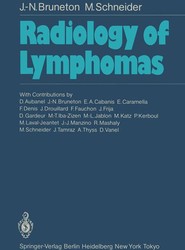 Radiology of Lymphomas
