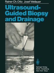 Ultrasound-Guided Biopsy and Drainage