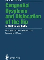 Congenital Dysplasia and Dislocation of the Hip in Children and Adults