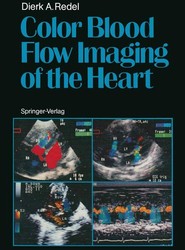 Color Blood Flow Imaging of the Heart
