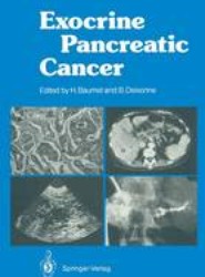 Exocrine Pancreatic Cancer