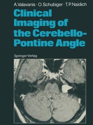 Clinical Imaging of the Cerebello-Pontine Angle