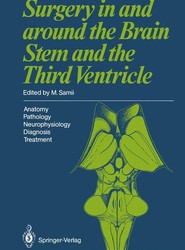 Surgery in and around the Brain Stem and the Third Ventricle