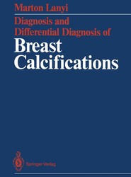 Diagnosis and Differential Diagnosis of Breast Calcifications