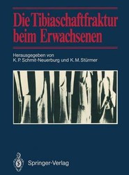 Die Tibiaschaftfraktur beim Erwachsenen