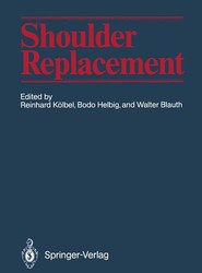 Shoulder Replacement