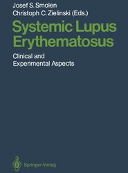 Systemic Lupus Erythematosus
