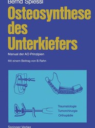 Osteosynthese des Unterkiefers